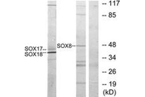 Western blot analysis of extracts from COS7 cells, treated with serum 10% 30', using SOX8/9/17/18 Antibody. (SOX8/9/17/18 antibody  (AA 116-165))