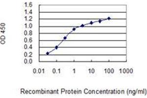Detection limit for recombinant GST tagged SAGE1 is 0. (SAGE1 antibody  (AA 357-455))