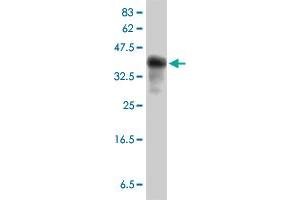 Western Blot detection against Immunogen (40. (IFITM3 antibody  (AA 1-133))