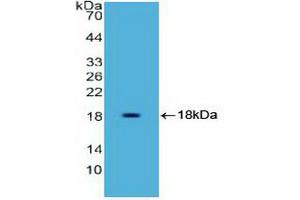 Western blot analysis of recombinant Human HMGA1. (HMGA1 antibody  (AA 3-107))