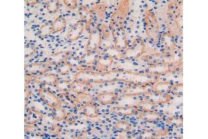 IHC-P analysis of kidney tissue, with DAB staining. (IL11RA antibody  (AA 59-217))