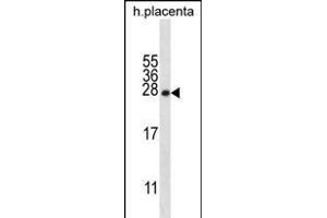 CRYBA1 Antibody (Center) (ABIN656311 and ABIN2845613) western blot analysis in human placenta tissue lysates (35 μg/lane). (CRYBA1 antibody  (AA 104-133))