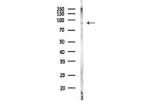 anti-ADAM Metallopeptidase Domain 9 (ADAM9) (C-Term) antibody