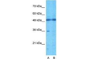 Host:  Rabbit  Target Name:  TMEM30A  Sample Type:  721_B  Lane A:  Primary Antibody  Lane B:  Primary Antibody + Blocking Peptide  Primary Antibody Concentration:  1ug/ml  Peptide Concentration:  5ug/ml  Lysate Quantity:  25ug/lane/lane  Gel Concentration:  0. (TMEM30A antibody  (Middle Region))