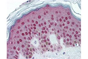 Anti-TFAP2A / AP2 Alpha antibody IHC of human skin.