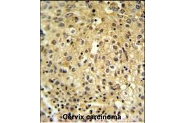 FYTTD1 antibody  (N-Term)