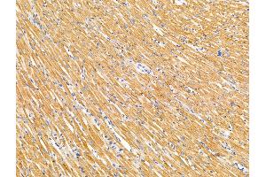 ABIN7094667 and ABIN7098718 at 1/100 staining Rat heart tissue by IHC-P.