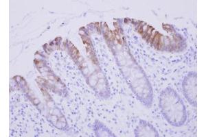IHC-P Image Biglycan antibody detects BGN protein at cytosol on human Colon Epithelium by immunohistochemical analysis.