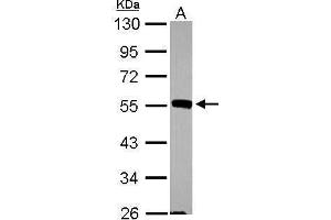 WB Image Sample (30 ug of whole cell lysate) A: MCF-7 10% SDS PAGE antibody diluted at 1:1000 (JNK2 antibody)