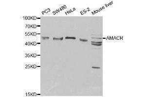 Western blot analysis of extracts of various cell lines, using AMACR antibody. (AMACR antibody  (AA 1-198))