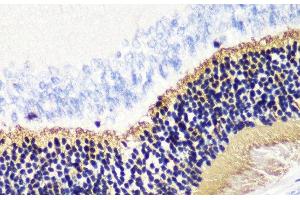 Immunohistochemistry of paraffin-embedded Rat retina using PDC Polyclonal Antibody at dilution of 1:200 (40x lens). (Phosducin antibody)