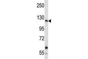 Insulin receptor R antibody western blot analysis in A549 lysate. (INSRR antibody  (AA 1228-1255))