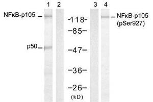 Western blot analysis of extract from HT-29 cells, untreated or treated with TNF-α and Calyculin A, using NFκB-p105/p50 (Ab-927) antibody (E021312, Lane 1 and 2) and NFκB-p105/p50 (Phospho-Ser927) antibody (E011312, Lane 3 and 4). (NFKB1 antibody  (pSer927))