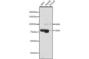 Western blot analysis of extracts of various cell lines, using GAA antibody (ABIN7267404) at 1:1000 dilution.