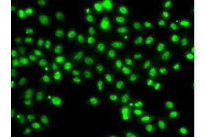 Immunofluorescence analysis of MCF-7 cells using SETBP1 antibody (ABIN5974342). (SETBP1 antibody)