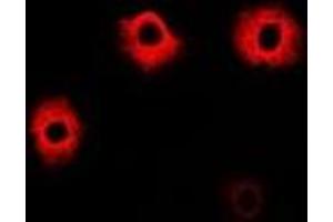 Immunofluorescent analysis of PIP4K2 beta staining in A549 cells.