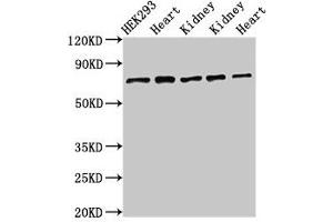 Western Blot Positive WB detected in: HEK293 whole cell lysate, Rat heart tissue, Rat kidney tissue, Mouse kidney tissue, Mouse heart tissue All lanes: SLC25A12 antibody at 3 μg/mL Secondary Goat polyclonal to rabbit IgG at 1/50000 dilution Predicted band size: 75, 63 kDa Observed band size: 75 kDa
