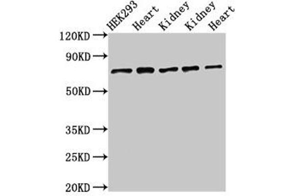 SLC25A12 抗体  (AA 202-317)