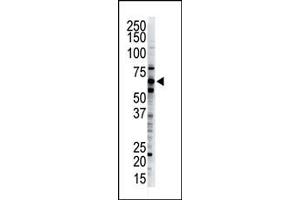 The anti-Dsk2 Pab (ABIN388964 and ABIN2839211) is used in Western blot to detect Dsk2 in HeLa cell lysate. (Ubiquilin 1 antibody  (C-Term))