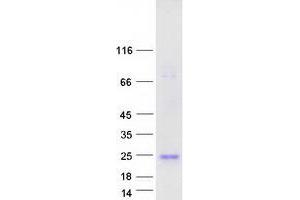 Validation with Western Blot (IFNA5 Protein (Myc-DYKDDDDK Tag))