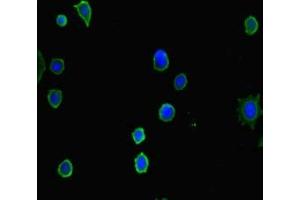 Immunofluorescent analysis of MCF-7 cells using ABIN7155318 at dilution of 1:100 and Alexa Fluor 488-congugated AffiniPure Goat Anti-Rabbit IgG(H+L) (HDAC5 antibody  (AA 1-100))