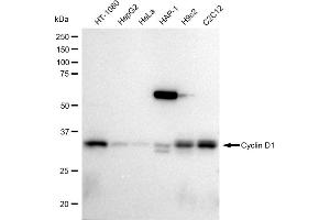 Western blotting analysis using Cyclin D1 antibody (ABIN7798194). (Recombinant Cyclin D1 antibody)