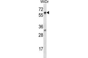 Western Blotting (WB) image for anti-La Ribonucleoprotein Domain Family, Member 7 (LARP7) antibody (ABIN2997066) (LARP7 antibody)