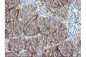 Image no. 2 for anti-V-Ral Simian Leukemia Viral Oncogene Homolog B (Ras Related, GTP Binding Protein) (Ralb) antibody (ABIN1500584) (RALB antibody)