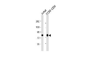 All lanes : Anti-MYB Antibody (Center) at 1:2000 dilution Lane 1: Jurkat whole cell lysate Lane 2: CCRF-CEM whole cell lysate Lysates/proteins at 20 μg per lane. (MYB antibody  (AA 1-185))