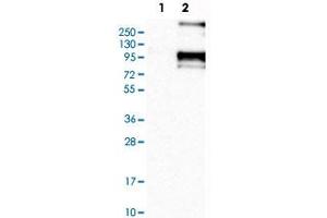 Western Blot analysis of Lane 1: negative control (vector only transfected HEK293T cell lysate) and Lane 2: over-expression lysate (co-expressed with a C-terminal myc-DDK tag in mammalian HEK293T cells) with SCNN1B polyclonal antibody . (SCNN1B antibody)