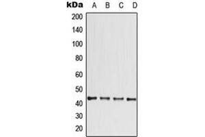 Western blot analysis of CCBE1 expression in ACHN (A), HeLa (B), SP2/0 (C), PC12 (D) whole cell lysates.