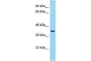 WB Suggested Anti-COQ9 Antibody Titration: 1.