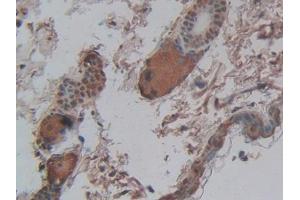 Used in DAB staining on fromalin fixed paraffin- embedded intestine tissue (CPB2 antibody  (AA 113-422))