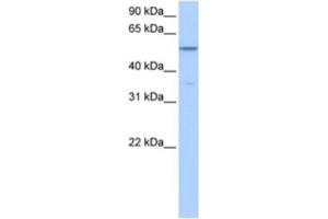 Western Blotting (WB) image for anti-Choline Kinase alpha (CHKA) antibody (ABIN2463572)