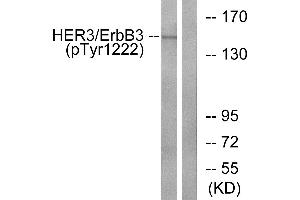 Western blot analysis of extracts from HUVEC cells, treated with EGF (200ng/ml, 30mins), using HER3/ErbB3 (Phospho-Tyr1222) antibody. (ERBB3 antibody  (pTyr1222))