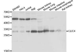 Western blot analysis of extracts of various cell lines, using CLIC4 antibody (ABIN5974262) at 1/1000 dilution. (CLIC4 antibody)