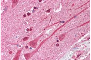 Human Brain, Cortex (formalin-fixed, paraffin-embedded) stained with ATF1 antibody ABIN214086 at 5 ug/ml followed by biotinylated goat anti-rabbit IgG secondary antibody ABIN481713, alkaline phosphatase-streptavidin and chromogen. (AFT1 antibody  (N-Term))