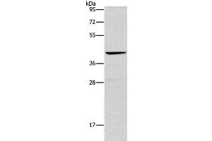 Western Blot analysis of Mouse liver tissue using ORM2 Polyclonal Antibody at dilution of 1:500 (Orosomucoid 2 antibody)