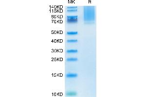 GPC1 Protein (AA 24-530) (His tag)