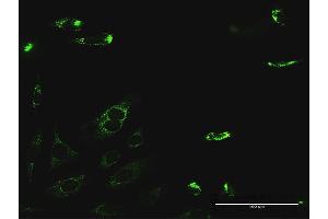 Immunofluorescence of purified MaxPab antibody to PYCR2 on HeLa cell. (PYCR2 antibody  (AA 1-320))