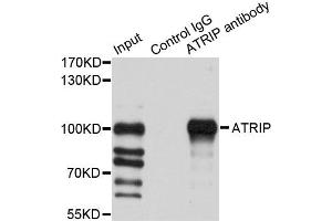 Immunoprecipitation analysis of 200ug extracts of HeLa cells using 1ug ATRIP antibody (ABIN2561292). (ATRIP antibody)