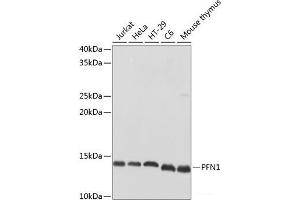 Western blot analysis of extracts of various cell lines using PFN1 Polyclonal Antibody at dilution of 1:500. (PFN1 antibody)