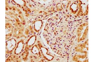 IHC image of ABIN7175958 diluted at 1:300 and staining in paraffin-embedded human kidney tissue performed on a Leica BondTM system. (YY1AP1 antibody  (AA 335-466))
