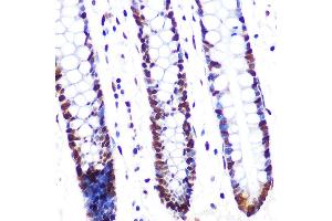 Immunohistochemistry of paraffin-embedded human colon using SRSF1/SRSF1/SF2/ASF Rabbit mAb (ABIN7270213) at dilution of 1:100 (40x lens). (SRSF1 antibody)