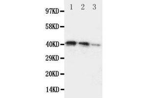 Lane 3: Recombinant Human DDR2 Protein 2. (DDR2 antibody  (C-Term))