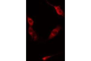 ABIN6275854 staining  Hela cells by IF/ICC. (PKN1 antibody  (Internal Region))