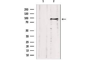 Western blot analysis of extracts from HepG2, using ODF2 antibody. (ODF2 antibody  (Internal Region))