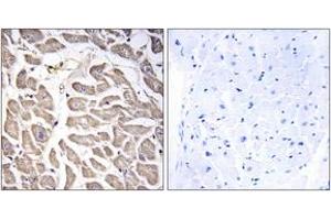 Immunohistochemistry analysis of paraffin-embedded human heart tissue, using BRWD3 Antibody. (BRWD3 antibody  (AA 1751-1800))