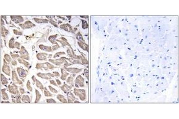 BRWD3 antibody  (AA 1751-1800)