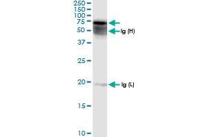 Immunoprecipitation of GALNS transfected lysate using anti-GALNS MaxPab rabbit polyclonal antibody and Protein A Magnetic Bead , and immunoblotted with GALNS MaxPab rabbit polyclonal antibody (D01) . (GALNS antibody  (AA 1-522))